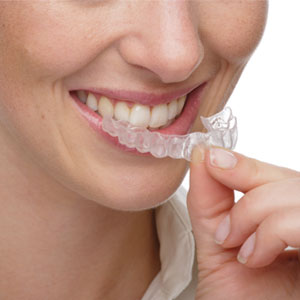 Best Orthodontist in Delhi NCR