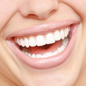 Teeth Whitening Treatment in Delhi